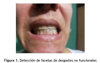 Férulas Dentales: Tu Mejor Defensa Contra el Bruxismo - Wintergerst